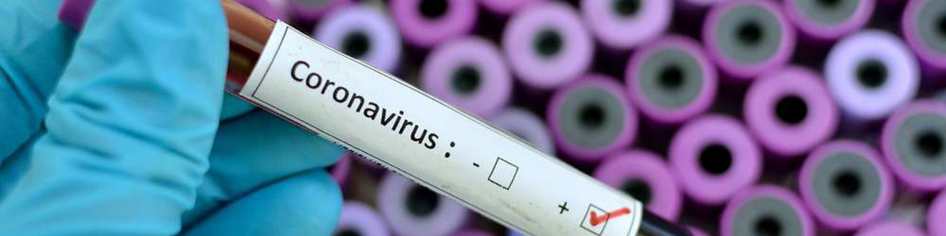Steckt der Coronavirus die deutsche Wirtschaft an?